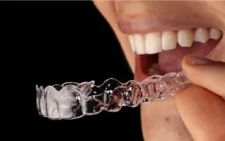 Aliado Dental-home-categoria